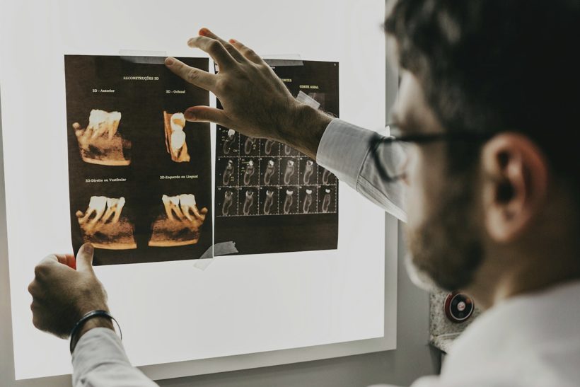 Prótese dentária e protocolo fixo sobre implantes na Odontoclinic Campo Limpo